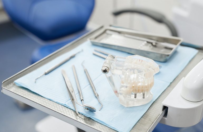 Tooth Prosthetics